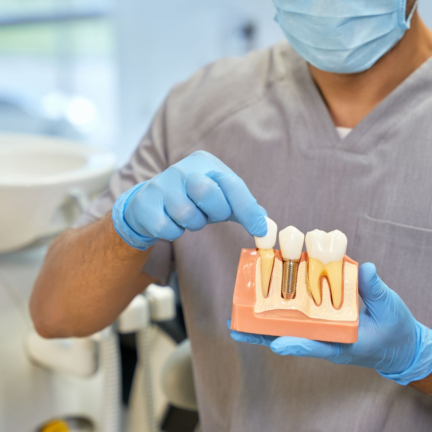 Impianti dentali mostrati da un dentista con un modello dimostrativo